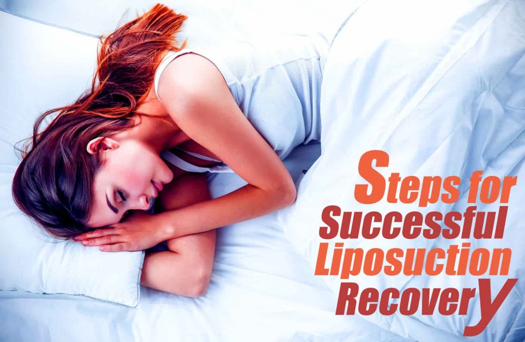 Recovery Steps for Liposuction