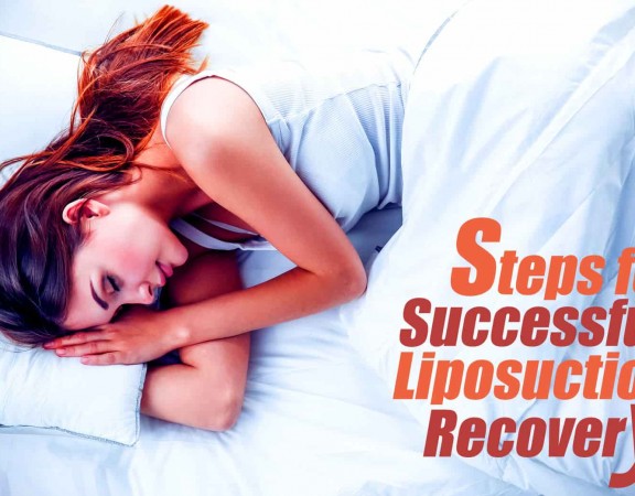 Recovery Steps for Liposuction