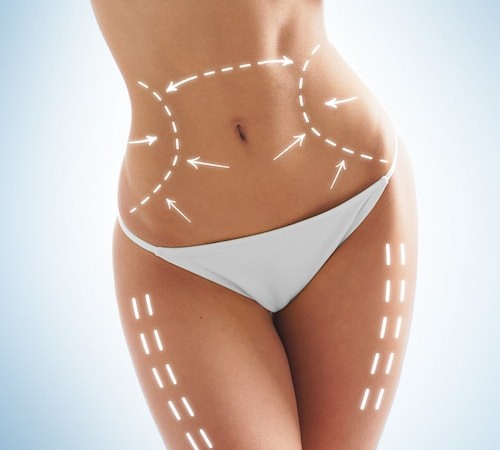 Discover the popular areas of the body to have liposuction