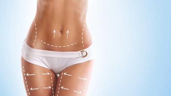 Liposuction options to remove fat