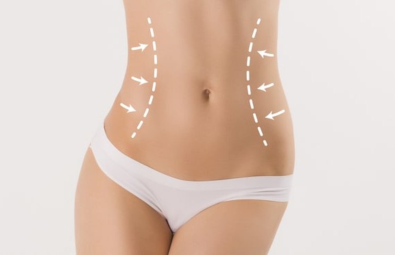 Is Liposuction Safe