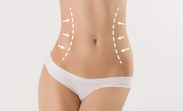 Is Liposuction Safe