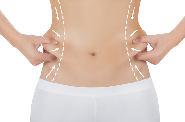 Liposuction Procedure Facts
